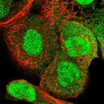 RECQL5 Antibody in Immunocytochemistry (ICC/IF)