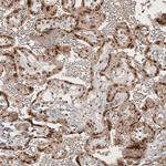 RECQL5 Antibody in Immunohistochemistry (Paraffin) (IHC (P))