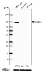 RECQL5 Antibody