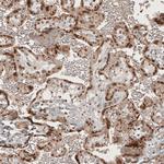 RECQL5 Antibody in Immunohistochemistry (IHC)