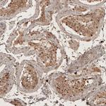 RECQL5 Antibody in Immunohistochemistry (IHC)