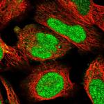 FTSJD2 Antibody in Immunocytochemistry (ICC/IF)