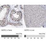 FTSJD2 Antibody in Immunohistochemistry (IHC)