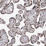 FTSJD2 Antibody in Immunohistochemistry (IHC)