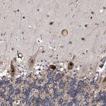 FTSJD2 Antibody in Immunohistochemistry (Paraffin) (IHC (P))