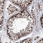 FTSJD2 Antibody in Immunohistochemistry (Paraffin) (IHC (P))