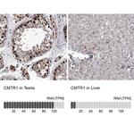 FTSJD2 Antibody