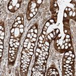 USP48 Antibody in Immunohistochemistry (Paraffin) (IHC (P))