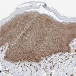 USP48 Antibody in Immunohistochemistry (Paraffin) (IHC (P))