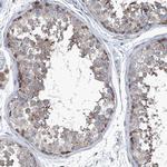 USP48 Antibody in Immunohistochemistry (Paraffin) (IHC (P))