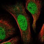 CDCA2 Antibody in Immunocytochemistry (ICC/IF)