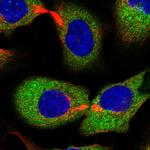 EPRS Antibody in Immunocytochemistry (ICC/IF)