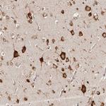 EPRS Antibody in Immunohistochemistry (Paraffin) (IHC (P))