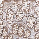 EPRS Antibody in Immunohistochemistry (Paraffin) (IHC (P))