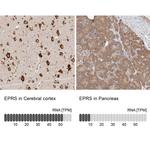 EPRS Antibody in Immunohistochemistry (IHC)