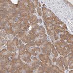 EPRS Antibody in Immunohistochemistry (IHC)