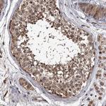 STK36 Antibody in Immunohistochemistry (IHC)