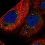 SMYD4 Antibody in Immunocytochemistry (ICC/IF)