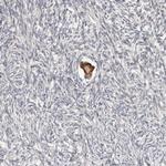 SMYD4 Antibody in Immunohistochemistry (IHC)