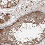 DNAJC28 Antibody in Immunohistochemistry (Paraffin) (IHC (P))