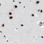 SF3A1 Antibody in Immunohistochemistry (IHC)