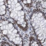 SF3A1 Antibody in Immunohistochemistry (IHC)