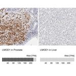 LMOD1 Antibody in Immunohistochemistry (IHC)