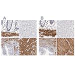 LMOD1 Antibody in Immunohistochemistry (IHC)