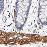 LMOD1 Antibody in Immunohistochemistry (IHC)