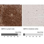 GBP4 Antibody in Immunohistochemistry (IHC)