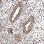 CAP1 Antibody in Immunohistochemistry (Paraffin) (IHC (P))