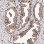 CAP1 Antibody in Immunohistochemistry (Paraffin) (IHC (P))