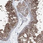 HSPB11 Antibody in Immunohistochemistry (Paraffin) (IHC (P))