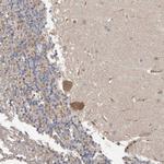 FBXO31 Antibody in Immunohistochemistry (Paraffin) (IHC (P))