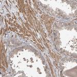 FBXO31 Antibody in Immunohistochemistry (Paraffin) (IHC (P))