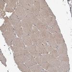 FBXO31 Antibody in Immunohistochemistry (Paraffin) (IHC (P))