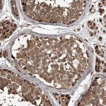 LTV1 Homolog Antibody in Immunohistochemistry (Paraffin) (IHC (P))