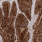 LTV1 Homolog Antibody in Immunohistochemistry (Paraffin) (IHC (P))