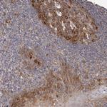 LTV1 Homolog Antibody in Immunohistochemistry (Paraffin) (IHC (P))