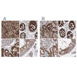 KLC4 Antibody in Immunohistochemistry (IHC)