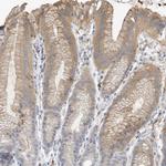 MICAL1 Antibody in Immunohistochemistry (Paraffin) (IHC (P))