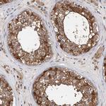 PDXK Antibody in Immunohistochemistry (IHC)