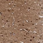 PDXK Antibody in Immunohistochemistry (IHC)