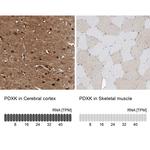 PDXK Antibody