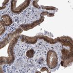 PDXK Antibody in Immunohistochemistry (Paraffin) (IHC (P))