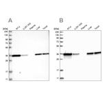 PDXK Antibody in Western Blot (WB)