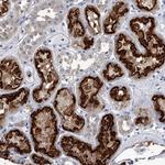 PDXK Antibody in Immunohistochemistry (Paraffin) (IHC (P))