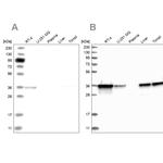 PDXK Antibody in Western Blot (WB)