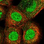 DST Antibody in Immunocytochemistry (ICC/IF)