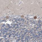 DST Antibody in Immunohistochemistry (Paraffin) (IHC (P))